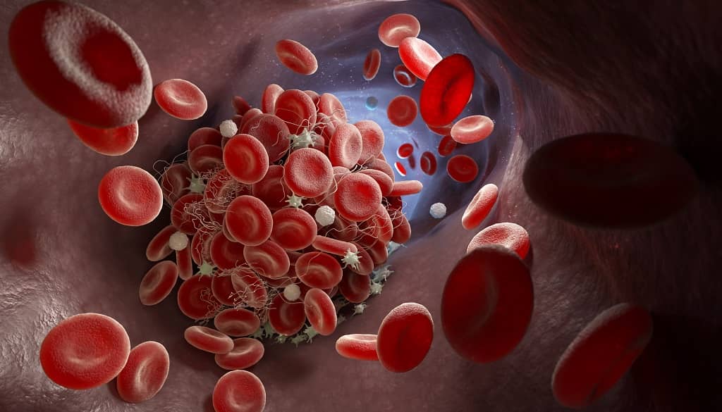 Platelets and other components of blood flowing through blood vessel