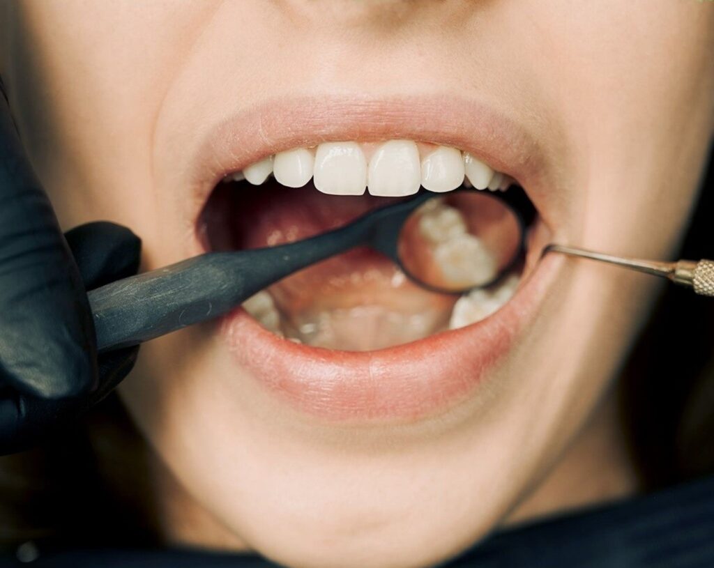 A person having a dental exam
