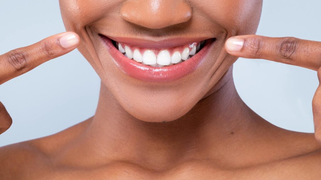 Woman with bright smile while pointing at her teeth with her fingers