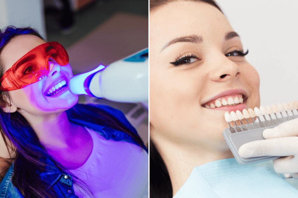 Teeth whitening and veneers procedures side-by-side.
